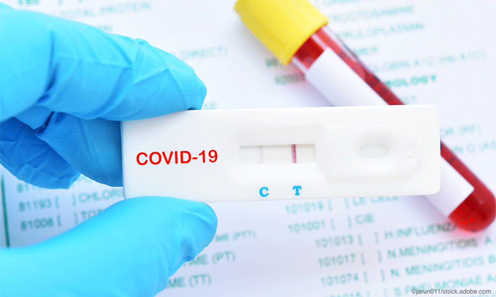 CareStart COVID-19 Antigen Rapid Test Kit Individually Packed 5 Tests