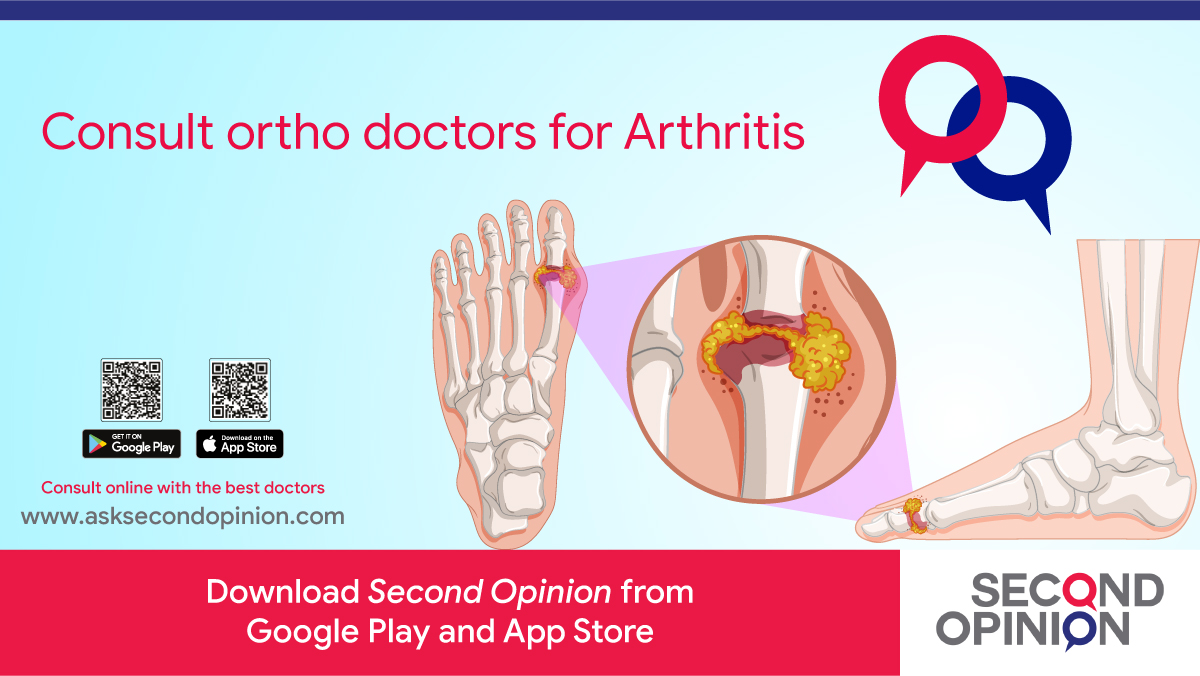 Orthopedic Online Consultation On Second Opinion App
