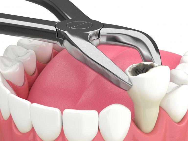 Get the Best Oral Surgery in Dentistry in Alvin Texas