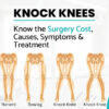 Knock Knee Surgery Cost In India